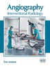Angiography: Interventional Radiology