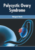 Polycystic Ovary Syndrome