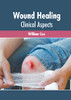 Wound Healing: Clinical Aspects