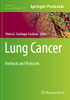 Lung Cancer: Methods and Protocols (Methods in Molecular Biology)