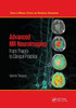 Advanced Mr Neuroimaging: From Theory To Clinical Practice (Series In Medical Physics And Biomedical Engineering)