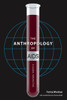 The Anthropology Of Aids: A Global Perspective