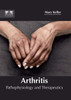 Arthritis: Pathophysiology And Therapeutics