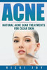 Acne: Natural Acne Scar Treatments For Clear Skin