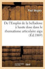 De l'Emploi de la belladone à haute dose dans le rhumatisme articulaire aigu (Sciences) (French Edition)