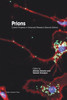 Prions : Current Progress In Advanced Research