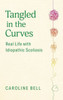 Tangled In The Curves: Real Life With Idiopathic Scoliosis