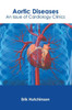 Aortic Diseases: An Issue of Cardiology Clinics