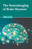 The Neuroimaging of Brain Diseases