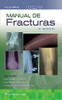 Manual de Fracturas (Spanish Edition)