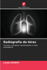 Radiografia do tórax