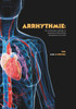 Arrhythmie: Ein umfassender Leitfaden zu Symptomen, Behandlung, Management und mehr!