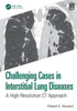 Challenging Cases in Interstitial Lung Diseases: A High-Resolution CT Approach - (Paperback or Softback)