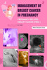 Management of Breast Cancer in Pregnancy: Pregnancy related Breast Cancer (PRBC)