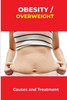 Obesity/overweight: Causes and Treatment