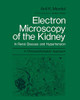 Electron Microscopy Of The Kidney: In Renal Disease And Hypertension: A Clinicopathological Approach