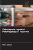 Zaburzenia rogówki Patofizjologia i leczenie