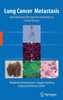 Lung Cancer Metastasis: Novel Biological Mechanisms and Impact on Clinical Practice