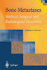 Bone Metastases: Medical, Surgical and Radiological Treatment