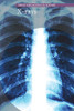 X-Rays (Great Discoveries In Science)