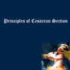 Principles of Cesarean Section