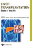 Liver Transplantation: State of the Art