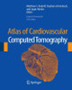 Atlas of Cardiovascular Computed Tomography: Includes Narrated Videos