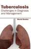 Tuberculosis: Challenges in Diagnosis and Management