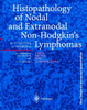 Histopathology of Nodal and Extranodal Non-Hodgkin's Lymphomas