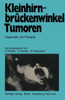 KleinhirnbrÃ¼ckenwinkel-Tumoren: Diagnostik Und Therapie
