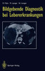 Bildgebende Diagnostik Bei Lebererkrankungen