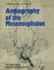 Angiography of the Mesencephalon: Normal and Pathological Findings
