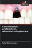 Considerazioni protesiche in odontoiatria implantare