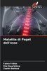 Malattia di Paget dell'osso
