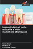 Impianti dentali nella mascella e nella mandibola atrofizzate