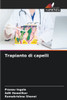 Trapianto di capelli