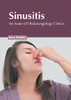 Sinusitis: An Issue of Otolaryngology Clinics