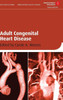 Adult Congenital Heart Disease