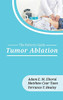 Tumor Ablation