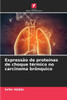 ExpressÃ£o de proteÃ­nas de choque tÃ©rmico no carcinoma brÃ´nquico