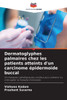 Dermatoglyphes palmaires chez les patients atteints d'un carcinome Ã©pidermoÃ¯de buccal