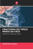 Fracturas Do Terço Médio Da Face
