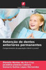 RetenÃ§Ã£o de dentes anteriores permanentes