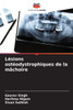 LÃ©sions ostÃ©odystrophiques de la mÃ¢choire