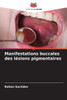 Manifestations buccales des lÃ©sions pigmentaires