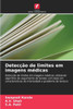 Detecção de limites em imagens médicas