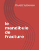 Le mandibule de fracture