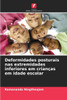 Deformidades posturais nas extremidades inferiores em crianças em idade escolar