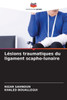 Lésions traumatiques du ligament scapho-lunaire