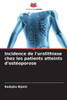 Incidence de l'urolithiase chez les patients atteints d'ostéoporose